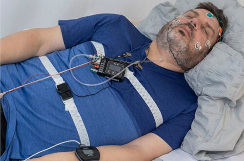 sleep study melbourne